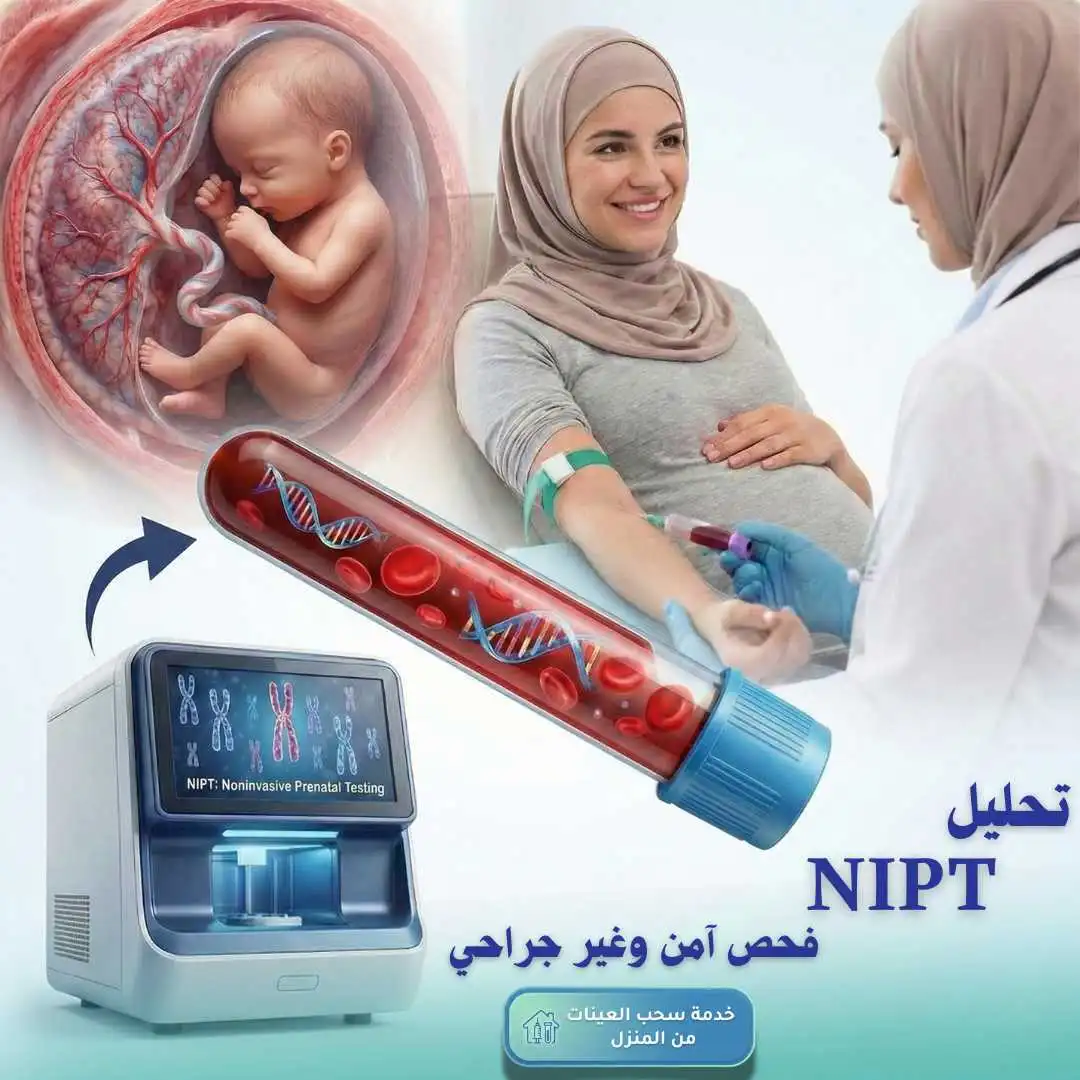 متى يُجرى تحليل NIPT؟